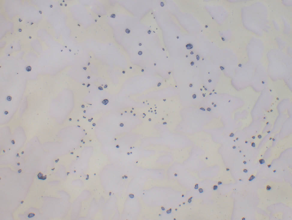 图 5 α-β 黄铜铸件